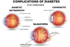 diabetes-and-eye-problems ಮಾರಕ ಮಧುಮೇಹ - ಭಾರೀ ಗಂಡಾಂತರ ಎಂದರೆ ದೃಷ್ಟಿ ಹಾನಿ