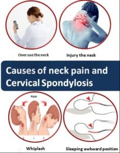 Causes-of-neck-pain-and-Cervical-Spondylosis