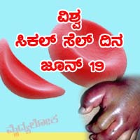 ಸಿಕಲ್ ಸೆಲ್ ಖಾಯಿಲೆ – ಅತಿಯಾದ ನೋವು ನೀಡುವ ವಿಶಿಷ್ಟ ರೋಗ