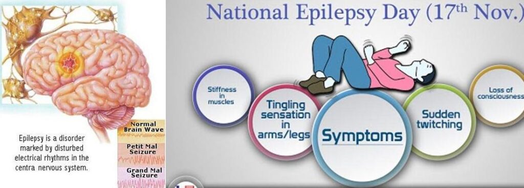 national-epilepsy-day.