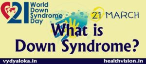 Down-syndrome/ ಡೌನ್ ಸಿಂಡ್ರೋಮ್ - ಗುಣಪಡಿಸಲು ಸಾಧ್ಯವಿಲ್ಲದ ಕ್ರೋಮೋಸೋಮ್‍ ವ್ಯತ್ಯಯದ ರೋಗ