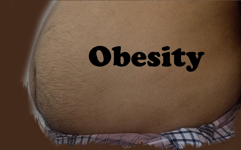 hotteya-bojju-obesity