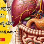 ಪಿತ್ತಕೋಶದ ಕಲ್ಲುಗಳು - ಕೋಲಿಸಿಸೈಟಿಸ್‌ ಸಮಸ್ಯೆಗೆ ಚಿಕಿತ್ಸೆ ಏನು