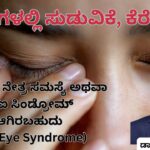 Kaṇṇugaḷalli suḍuvike athavā keretavē Dr Hareesh K V, #abhisheknethradhama #eyehospital #yelahanka #eyeproblems #vydyaloka #healthvision Abhishek Nethradhama #drhareesh #dryeyesyndrome