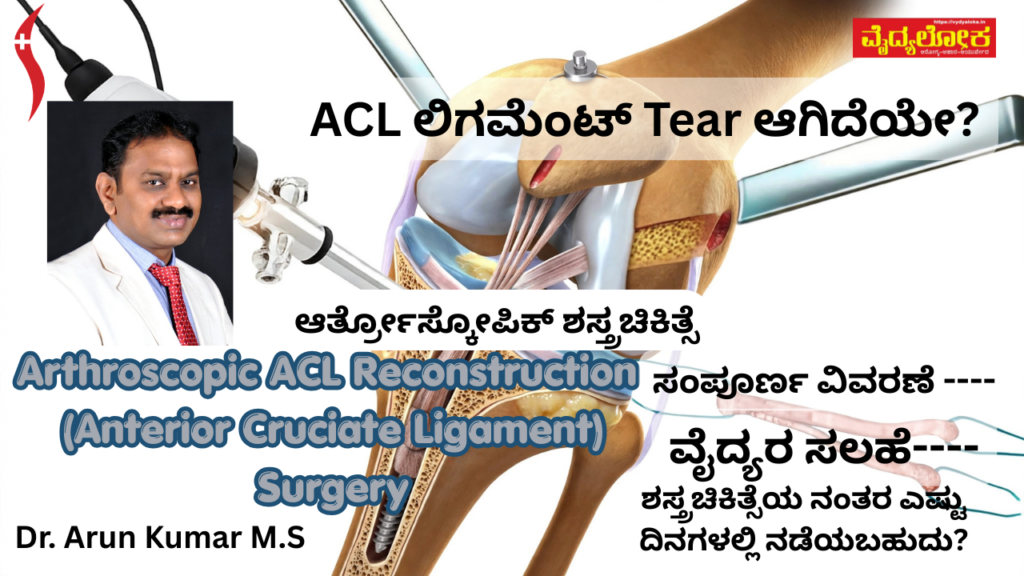 Arthroscopic ACL Reconstruction Surgery - #vydyaloka #healthvision #deeksha #bonehealth #yelahanka