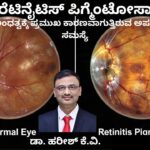 ರೆಟಿನೈಟಿಸ್ ಪಿಗ್ಮೆಂಟೋಸಾ - ಅಂಧತ್ವಕ್ಕೆ ಕಾರಣವಾಗುವ ಸಮಸ್ಯೆ Retinitis Pigmentosa Yuvakaralli andhatvakke kāraṇavāguttiruva kaṇṇina samasye #abhisheknethradhama #drhareeshkv #eyehospital #yelahanka #vydyaloka #healthvision
