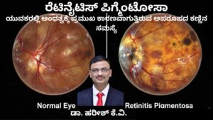 Retinitis Pigmentosa Yuvakaralli andhatvakke kāraṇavāguttiruva kaṇṇina samasye #abhisheknethradhama #drhareeshkv #eyehospital #yelahanka #vydyaloka #healthvision