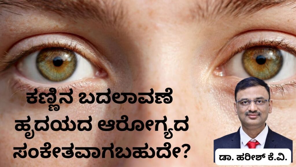 Kaṇṇina badalāvaṇegaḷu hr̥udayada ārōgyada saṅkētavāgabahudē Dr Hareesh K V, #abhisheknethradhama #vydyaloka #healthvision #drhareesh